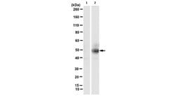 phospho-cytokeratin-18 (K18) (Ser33), Mouse anti-Human, Clone: IB4, Millipore